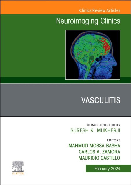 Vasculitis, An Issue Of Neuroimaging Clinics Of North America,34-1