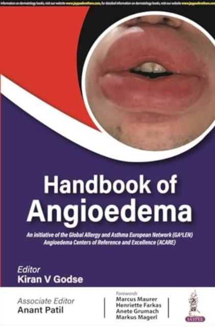 Handbook of angioedema