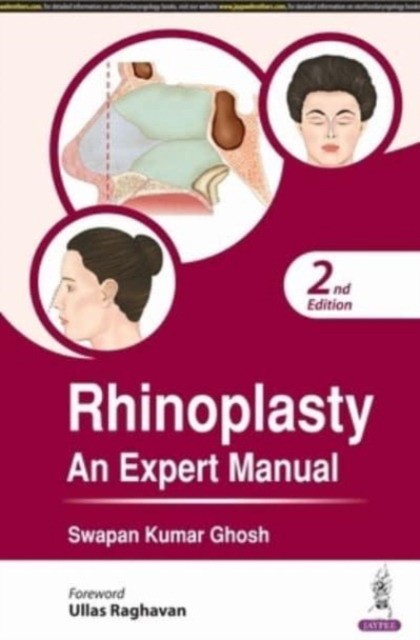 Rhinoplasty