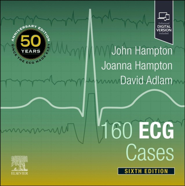 160 ECG Cases , 6 ed.
