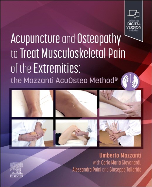 Acupuncture and osteopathy to treat musculoskeletal pain of the extremities