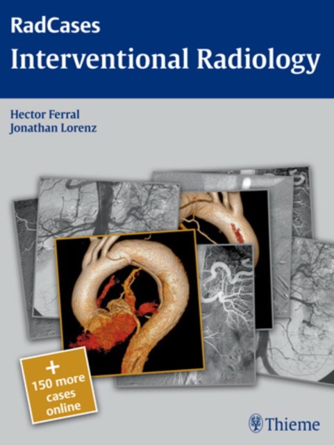 Rad cases: Interventional Radiology Rad cases: Interventional Radiology