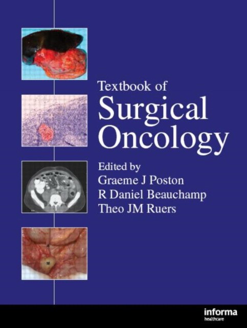 Textbook Surgical Oncology Textbook Surgical Oncology