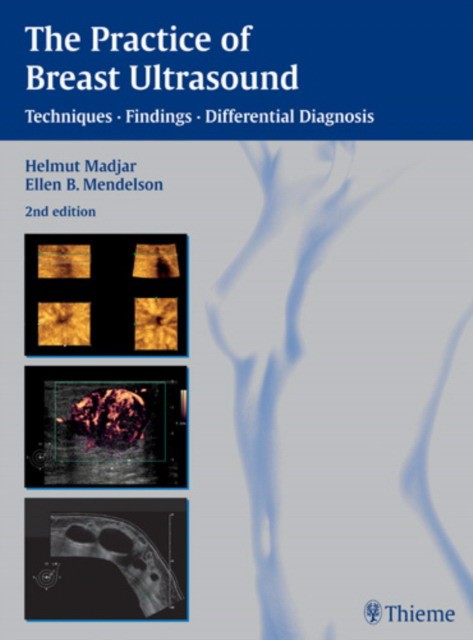 The Practice of Breast Ultrasound: Techniques, Findings, Differential Diagnosis The Practice of Breast Ultrasound: Techniques, Findings, Differential Diagnosis
