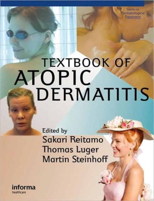 Textbook Atopic Dermatitis Textbook Atopic Dermatitis