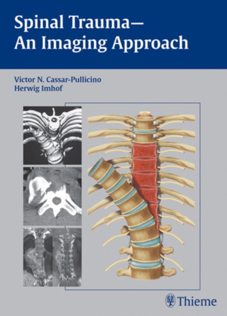 Spinal Trauma - An Imaging Approach Spinal Trauma - An Imaging Approach