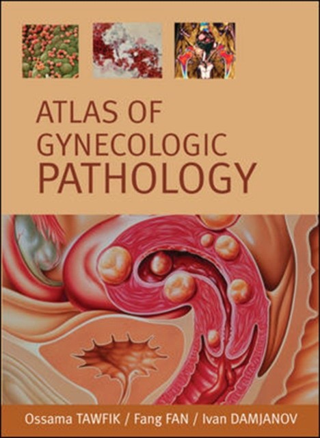Atlas of Gynecological Pathology. 2007 Atlas of Gynecological Pathology. 2007