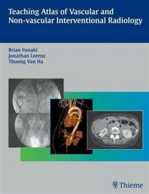 Teaching Atlas of Vascular and Non-vascular Interventional Radiology Teaching Atlas of Vascular and Non-vascular Interventional Radiology