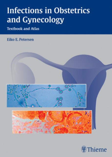 Infections in Obstetrics and Gynecology: Textbook and Atlas Infections in Obstetrics and Gynecology: Textbook and Atlas