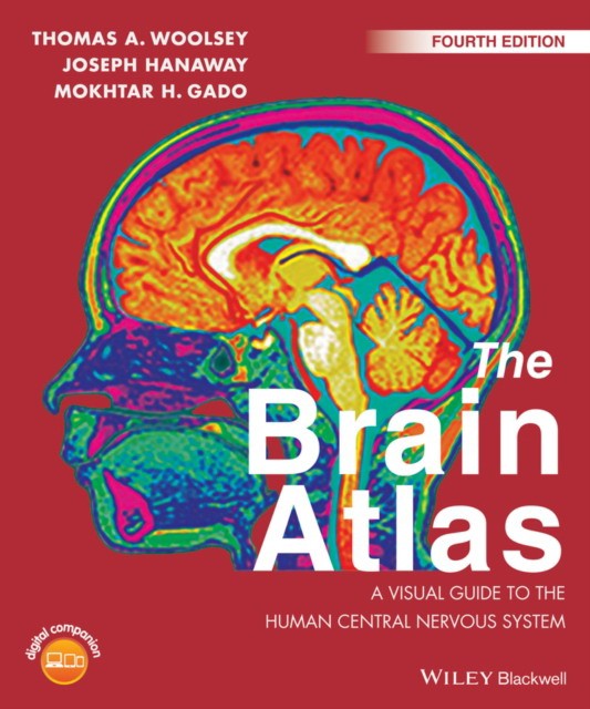 Brain atlas