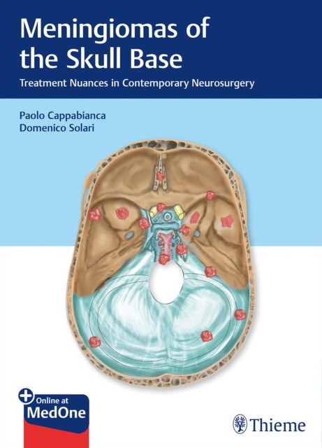 Meningiomas of the Skull Base