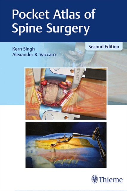 Pocket Atlas of Spine Surgery