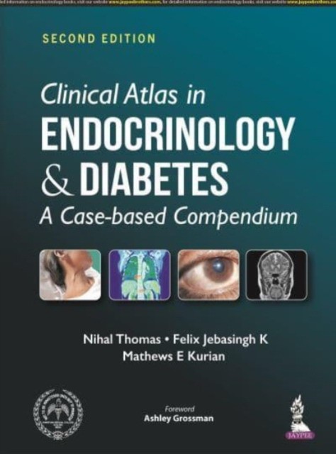 Clinical atlas in endocrinology and diabetes Clinical atlas in endocrinology and diabetes