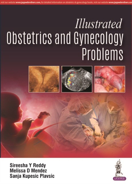 Illustrated Obstetrics and Gynecology Problems Illustrated Obstetrics and Gynecology Problems