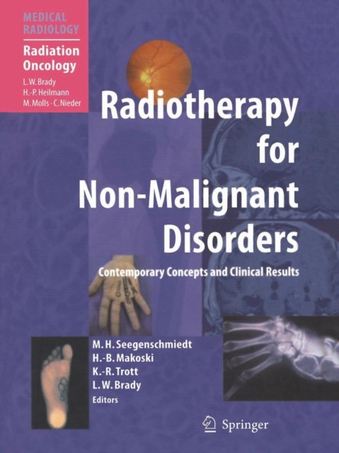 Radiotherapy for Non-Malignant Disorders Radiotherapy for Non-Malignant Disorders
