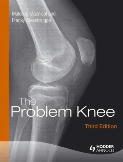 The Problem Knee, Third Edition The Problem Knee, Third Edition