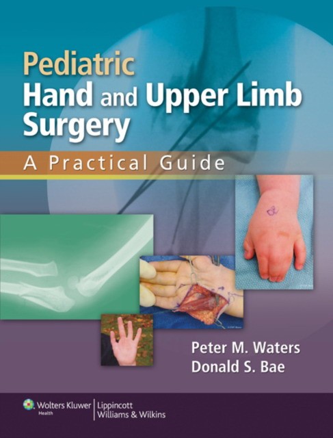 Pediatric hand & upper limb surgery cb Pediatric hand & upper limb surgery cb
