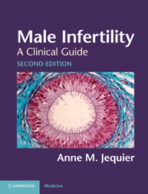 Male Infertility Male Infertility
