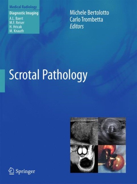 Scrotal pathology Scrotal pathology