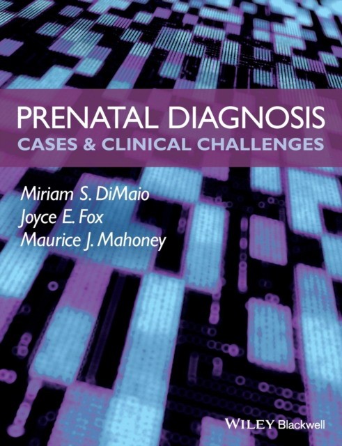 Prenatal Diagnosis Prenatal Diagnosis