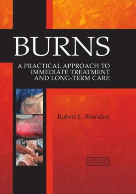 Burns - A Practical Approach Burns - A Practical Approach