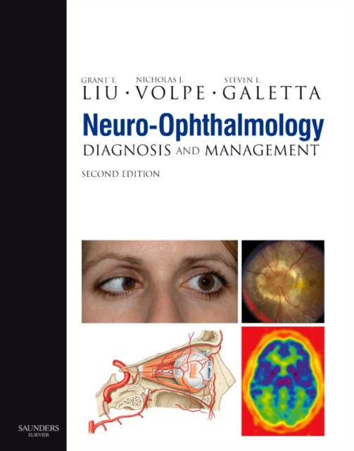 Neuro-Ophthalmology Neuro-Ophthalmology
