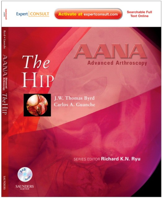 AANA Advanced Arthroscopy: The Hip AANA Advanced Arthroscopy: The Hip