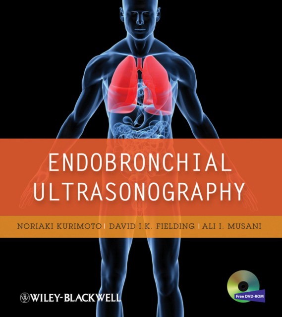 Endobronchial Ultrasonography Endobronchial Ultrasonography