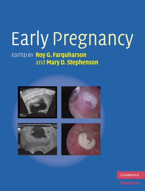 Early Pregnancy Early Pregnancy