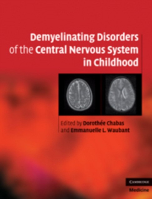 Demyelinating Disorders of the Central Nervous System in Childhood Demyelinating Disorders of the Central Nervous System in Childhood