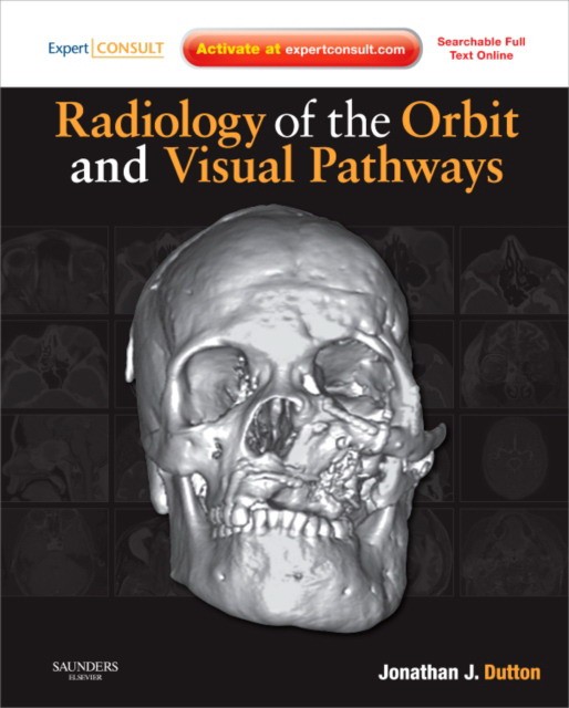 Radiology of the Orbit and Visual Pathways Radiology of the Orbit and Visual Pathways