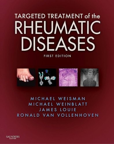 Targeted treatment of the rheumatic diseases Targeted treatment of the rheumatic diseases