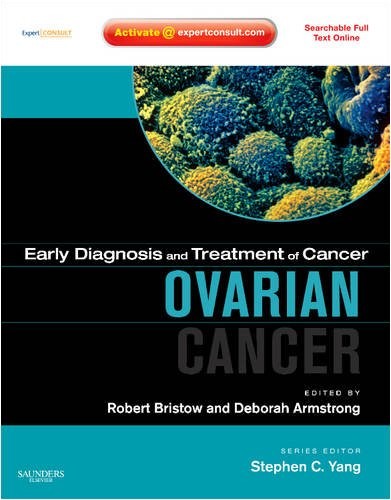 Early Diagnosis and Treatment of Cancer Series: Ovarian Cancer: Expert Consult: Online and Print Early Diagnosis and Treatment of Cancer Series: Ovarian Cancer: Expert Consult: Online and Print