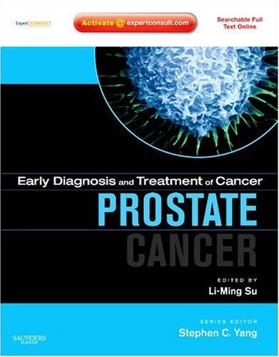 Early Diagnosis and Treatment of Cancer Series: Prostate Cancer: Expert Consult: Online and Print Early Diagnosis and Treatment of Cancer Series: Prostate Cancer: Expert Consult: Online and Print