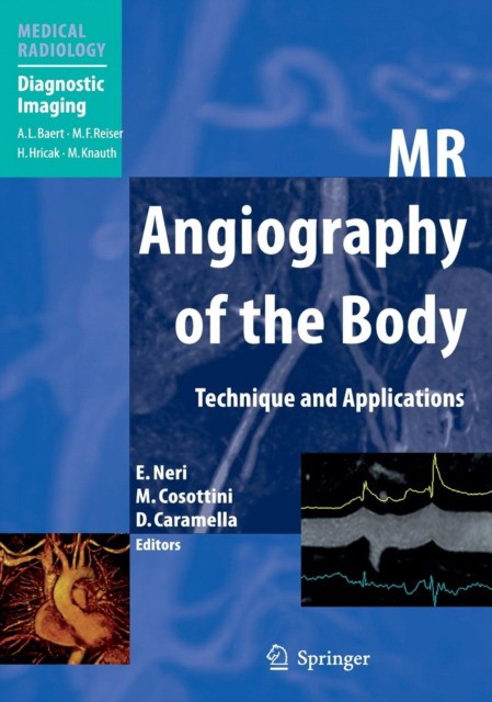MR Angiography of the Body MR Angiography of the Body