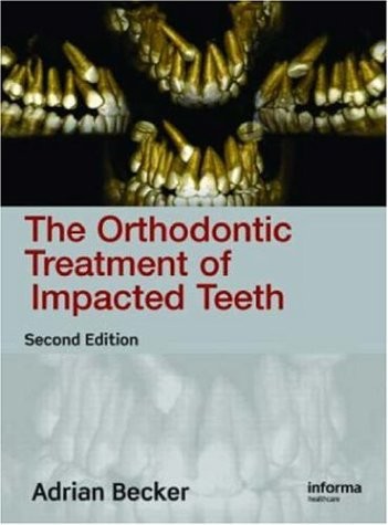 Orthodontic Treatment Impacted Teeth 2E Orthodontic Treatment Impacted Teeth 2E