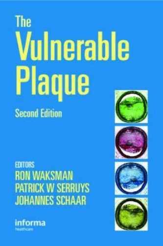 The Vulnerable Plaque, 2E The Vulnerable Plaque, 2E