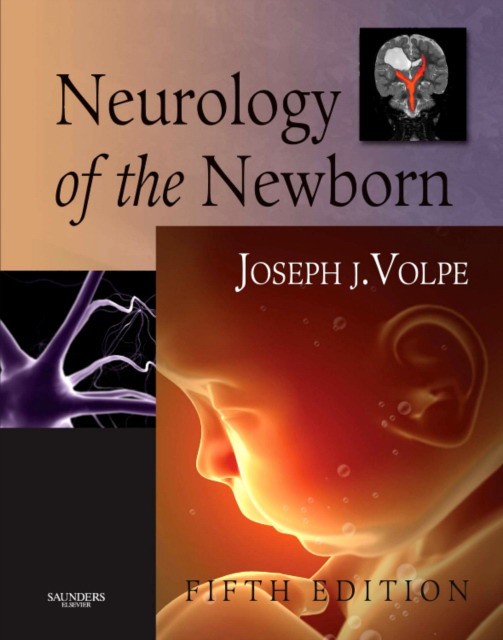 Neurology of the Newborn