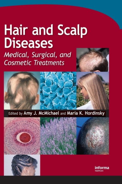 Hair and Scalp Diseases: Medical, Surgical, and Cosmetic Treatments Hair and Scalp Diseases: Medical, Surgical, and Cosmetic Treatments