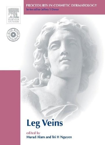 Procedures in Cosmetic Dermatology Series: Treatment of Leg Veins Procedures in Cosmetic Dermatology Series: Treatment of Leg Veins
