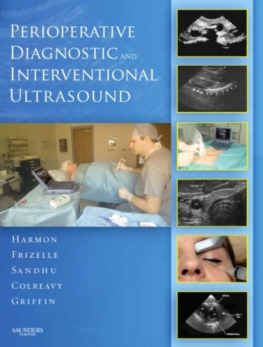 Perioperative Diagnostic and Interventional Ultrasound with DVD Perioperative Diagnostic and Interventional Ultrasound with DVD