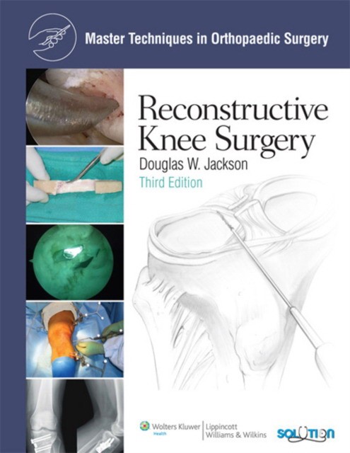 Mtos: recon knee surgery 3e cb Mtos: recon knee surgery 3e cb