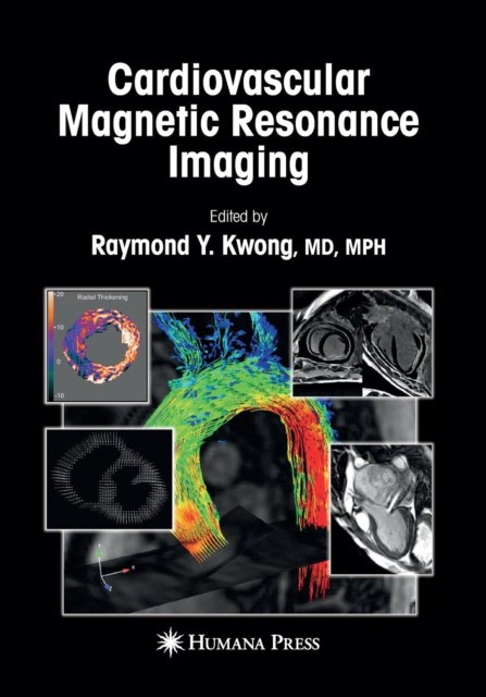 Cardiovascular Magnetic Resonance Imaging Cardiovascular Magnetic Resonance Imaging