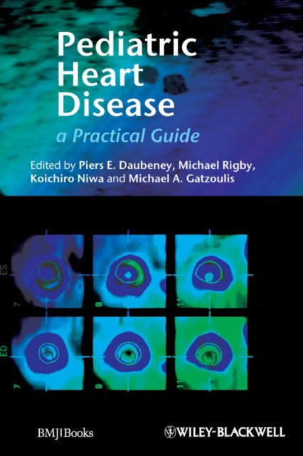 Perdiatric Heart Disease; a pract. Guide.