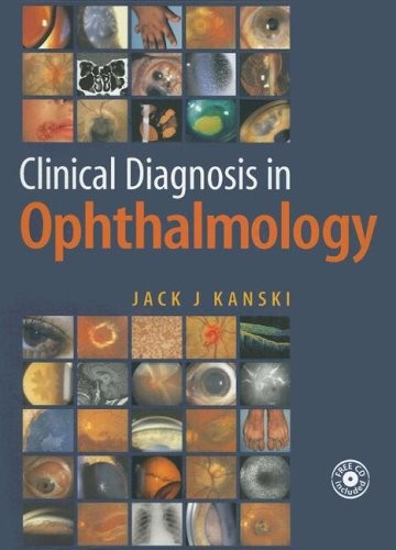 Clinical Diagnosis in Ophthalmology Clinical Diagnosis in Ophthalmology