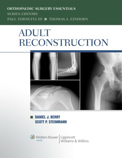 Adult Reconstruction Adult Reconstruction