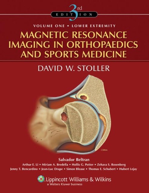 Magnetic Resonance Imaging in Orthopaedics and Sports Medicine 3/e (Two Volume Set) Magnetic Resonance Imaging in Orthopaedics and Sports Medicine 3/e (Two Volume Set)
