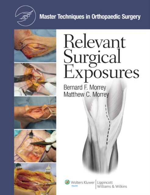 Master Techniques in Orthopaedic Surgery: Surgical Exposures Master Techniques in Orthopaedic Surgery: Surgical Exposures
