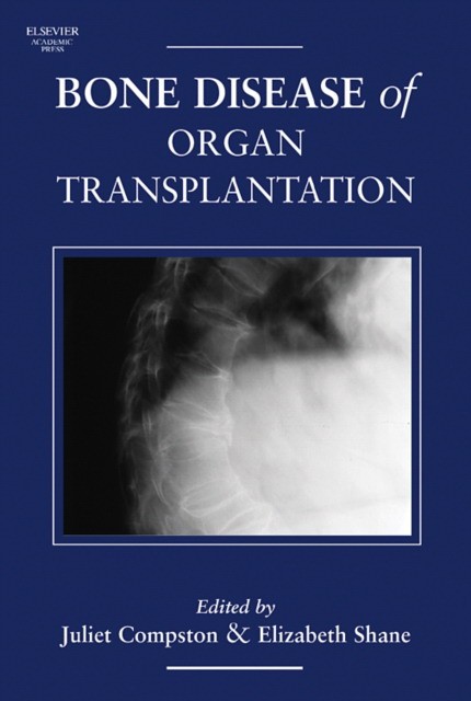 Bone Disease of Organ Transplantation, Bone Disease of Organ Transplantation,