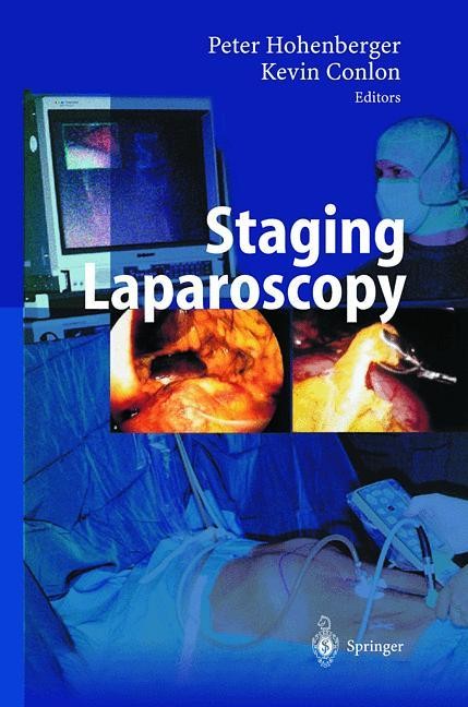 Staging Laparoscopy.2002 Staging Laparoscopy.2002